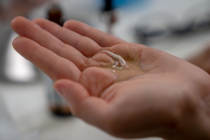 Sieht aus, als hätte mir ein Vogel auf die Hand geschissen.