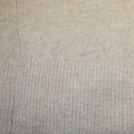 Nachher: Die dunklen Schatten (Pilling) sind fast weg.