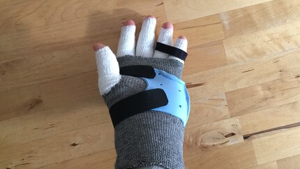 Sag Hallo zum eiskalten Händchen.