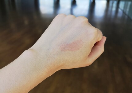 Auch an der Hand getestet: Nach knapp 45 Minuten rötet sich die Haut. Weil diese am Körper dicker ist als an den Lippen, dauert es länger, bis eine Reaktion eintritt.