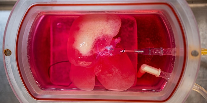 Source: UPMC Source: UPMC