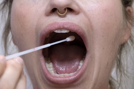 Les prélèvements sont rapides et fiables.