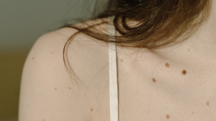 Der Träger soll möglichst direkt auf der Schulter liegen und darf die Haut dennoch nicht einschnüren.