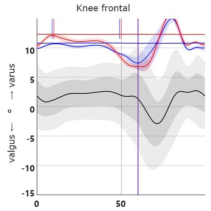 My knees point slightly inwards, my shins bend outwards.
