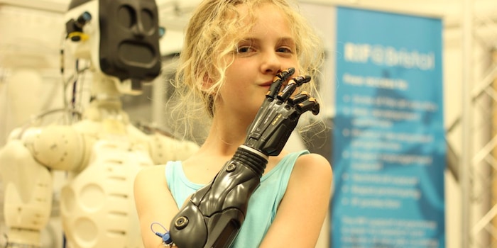 Tilly Lockey ist 10 Jahre alt, Cyborg, Internetphänomen und Sprecherin für Amputierte. Tilly Lockey ist 10 Jahre alt, Cyborg, Internetphänomen und Sprecherin für Amputierte.