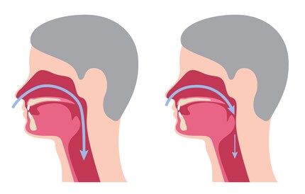 On the left, the air has a clear path; on the right, there’s tissue in the way.