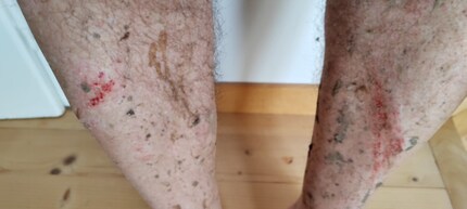 It doesn’t look nice, but it’s peanuts.