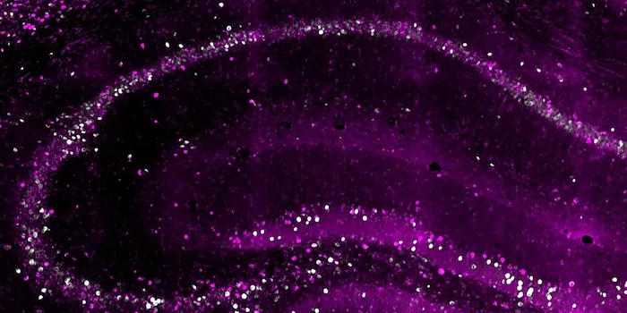 © Biozentrum, University of Basel (extrait) Les neurones "plus anciens" (en rose) de l'hippocampe créent une copie de longue durée d'un souvenir. © Biozentrum, University of Basel (extrait) Les neurones "plus anciens" (en rose) de l'hippocampe créent une copie de longue durée d'un souvenir.