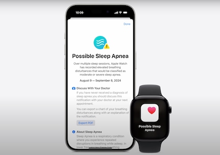 Misst die Apple Watch zu viele Atemaussetzer in einer Nacht, zeigt sie eine Warnung an. 