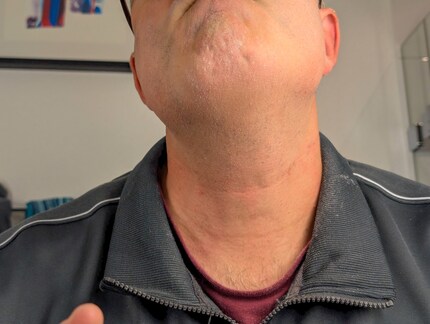 Nach der Rasur entdecke ich kaum mehr Hautirritationen.