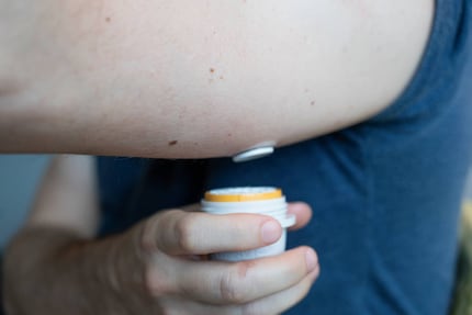 Fatto! Il sensore si adatta perfettamente e ora accompagnerà Res per due settimane, in modo così discreto che spesso se ne dimenticherà.