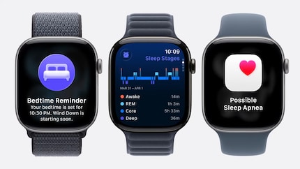 Questo è l'Apple Watch 11.