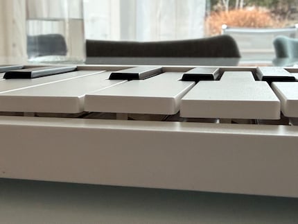 Wäre ich Zahnarzt, würde ich hier gegen die Fehlstellung eine Zahnspange empfehlen.