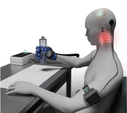 Das NEO-Brain-Computer-Interface überträgt Hirnsignale an ein externes Gerät, das am Arm befestigt ist. Dieses gibt die Signale an den Host-Computer weiter, der dann einen tragbaren pneumatischen Handschuh steuert, um Objekte zu greifen.