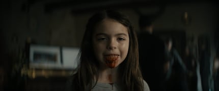 Zahnfleischbluten oder zu viel Ketchup, man weiss es nicht.