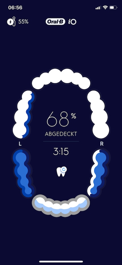 Wenn ich zufrieden bin, sagt die App, ich hätte diverse Bereiche nicht richtig geputzt.