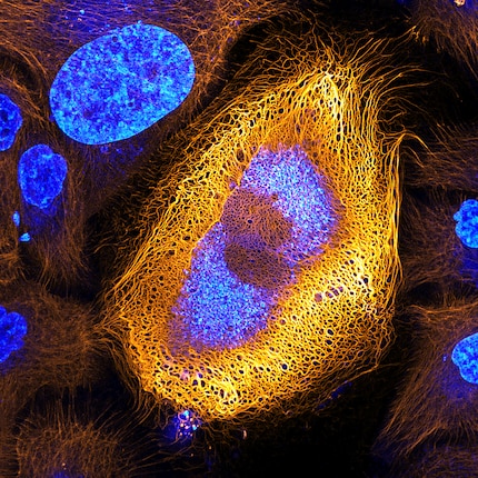 Winner 2017: Skin cells